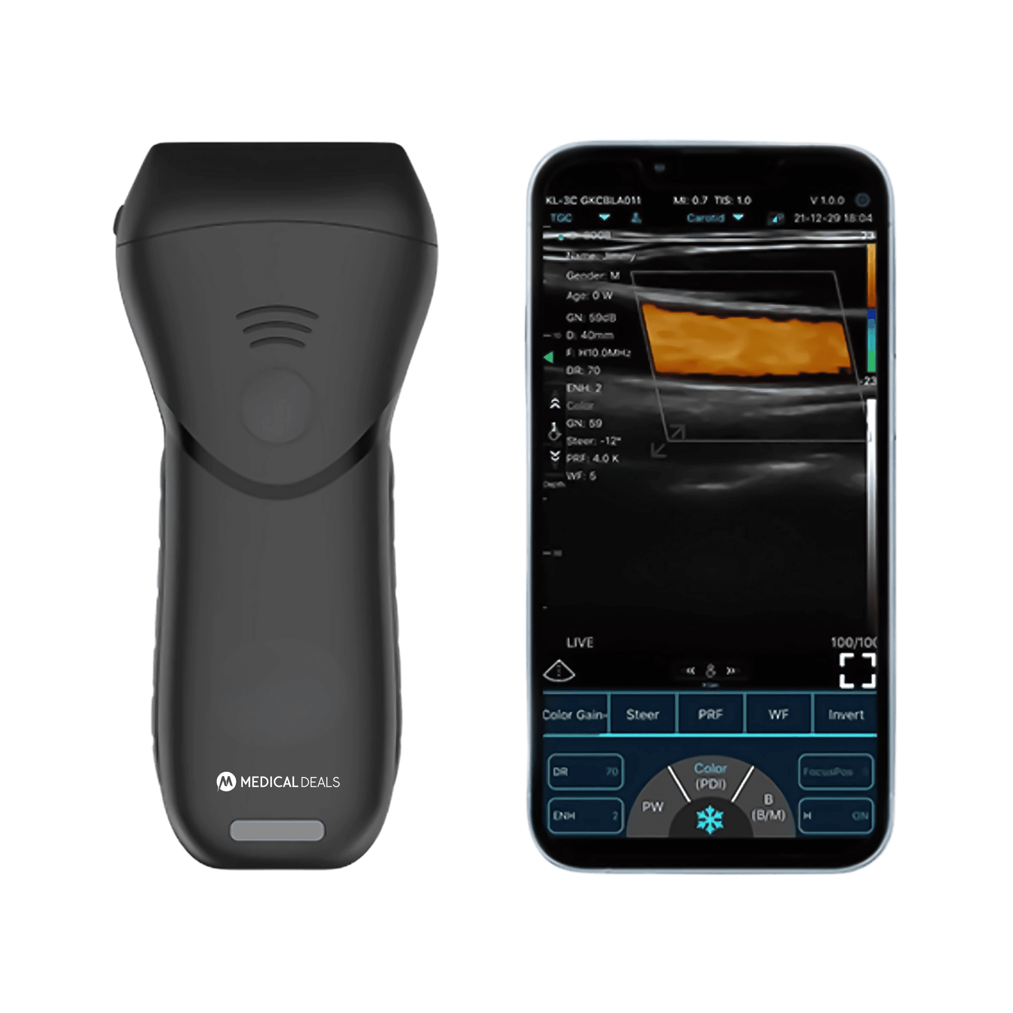 Handheld Ultrasound Device MD-HUSG-1000