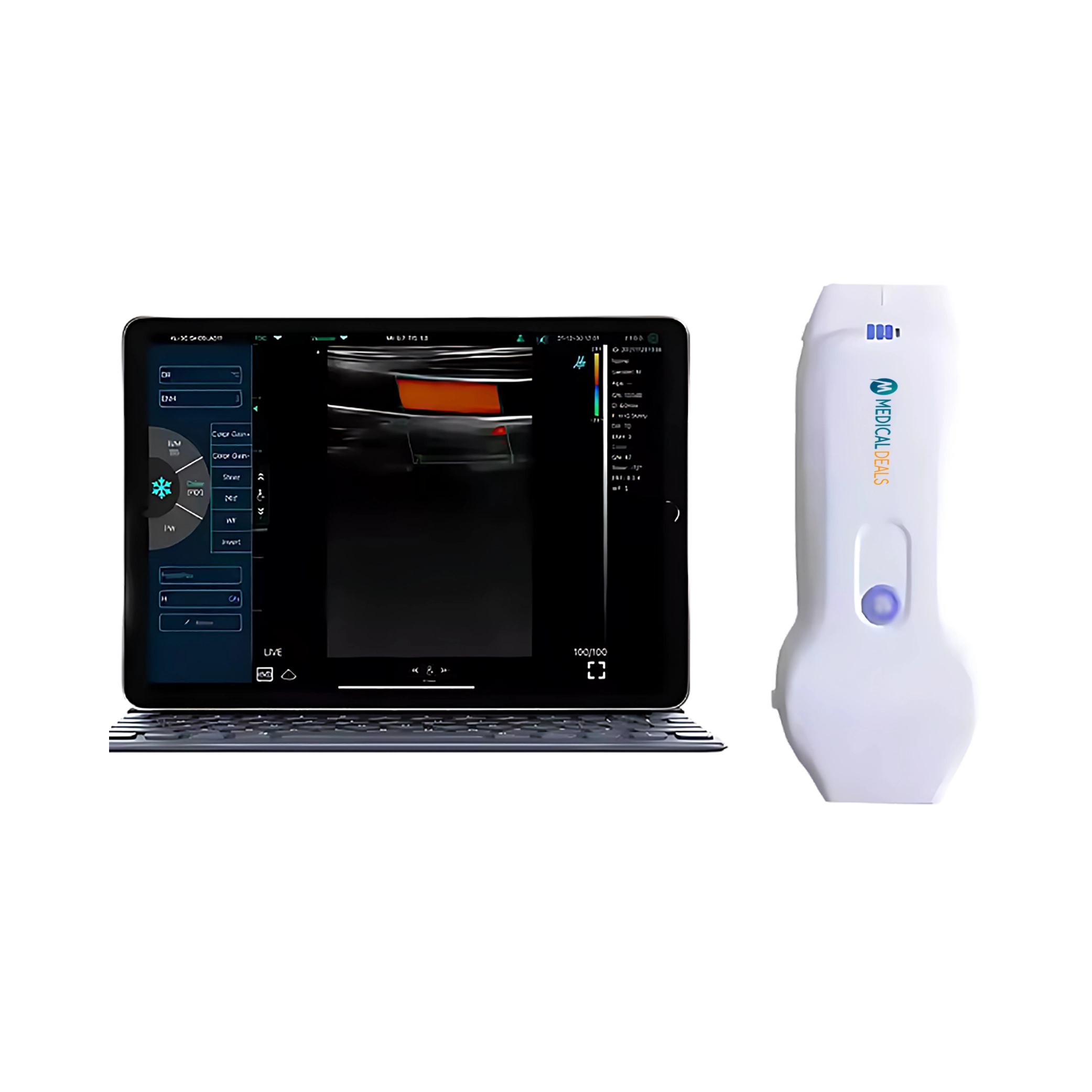 Handheld Ultrasound Device MD-HUSG-1002