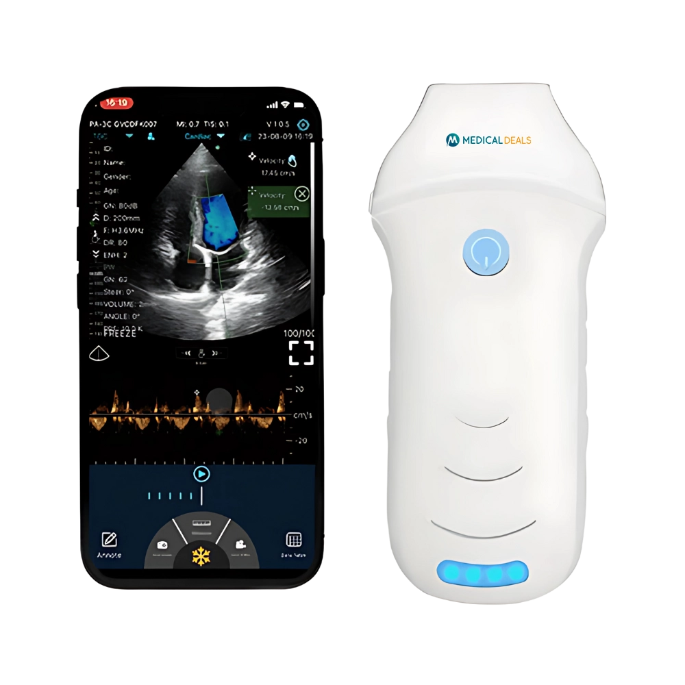 Handheld Ultrasound Device MD-HUSG-1005