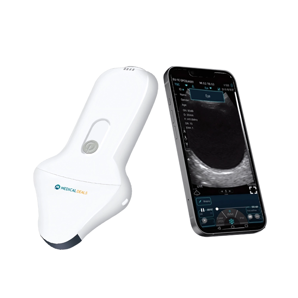 Handheld Ultrasound Device MD-HUSG-1012