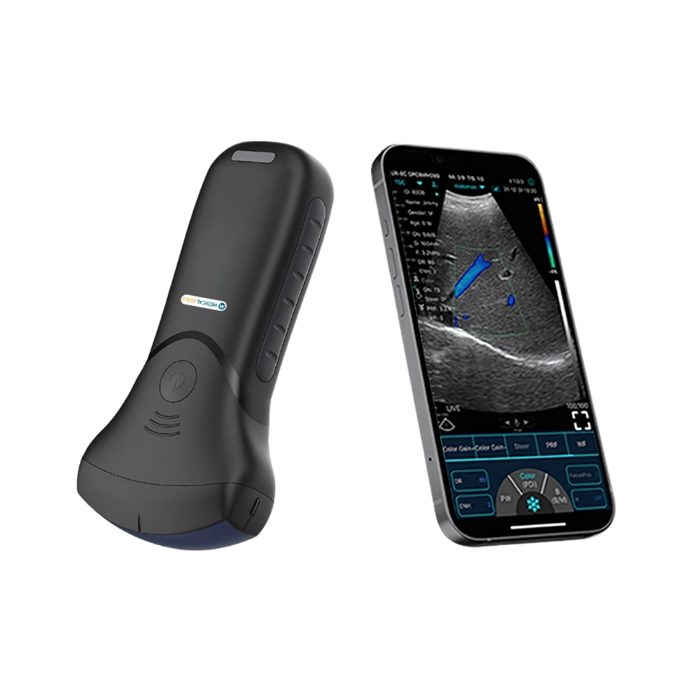 Handheld Ultrasound Device MD-HUSG-1014
