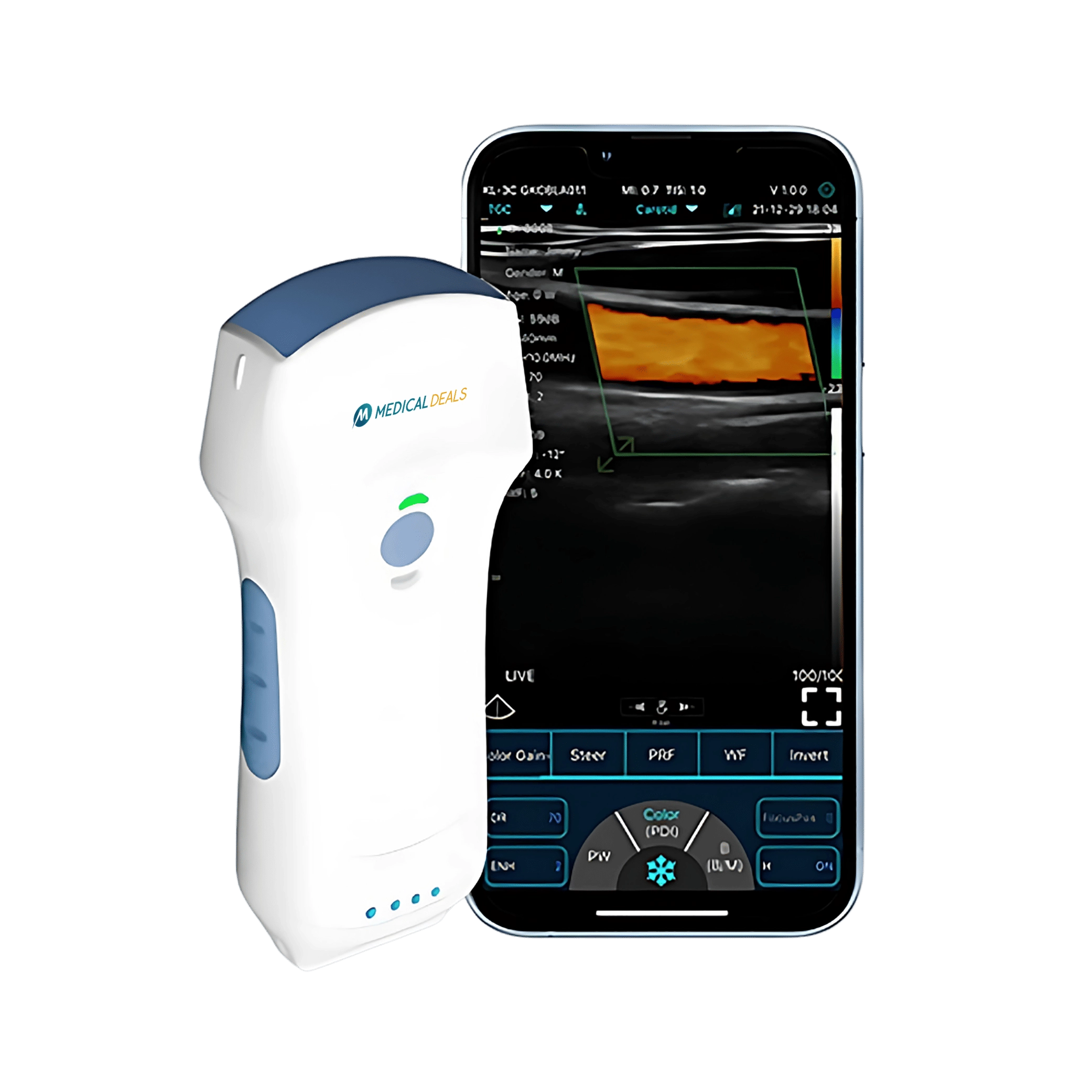 Handheld Ultrasound Device MD-HUSG-2000