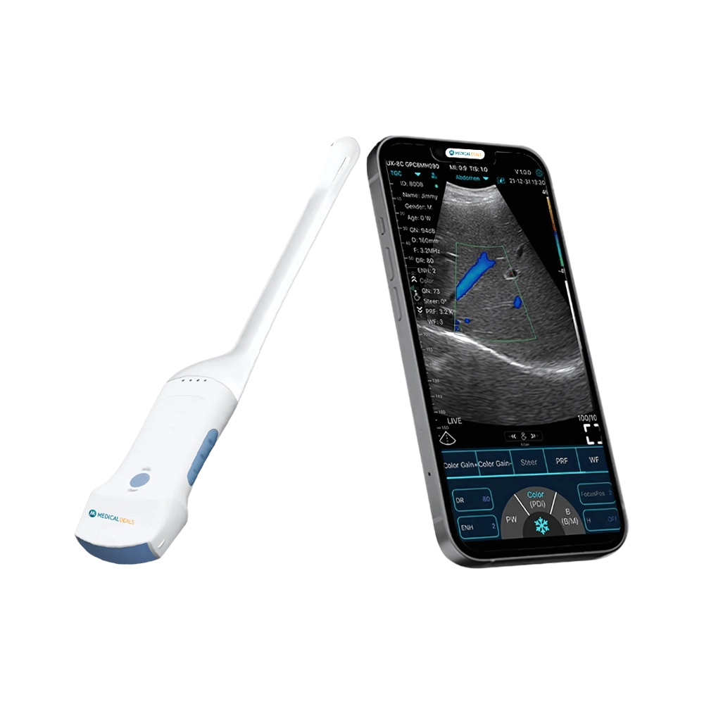 Handheld Ultrasound Device MD-HUSG-3002
